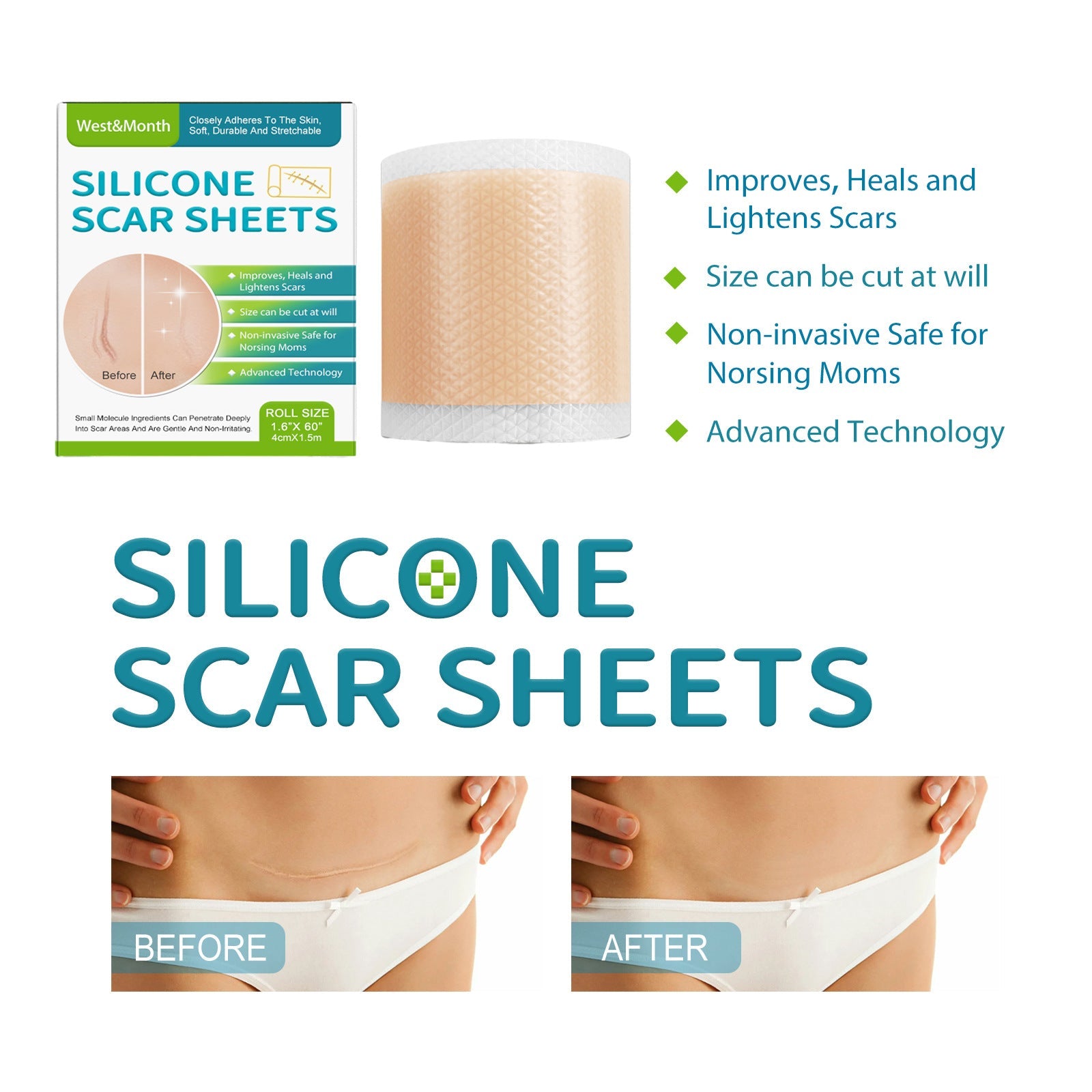 Scar patch applied to skin close-up