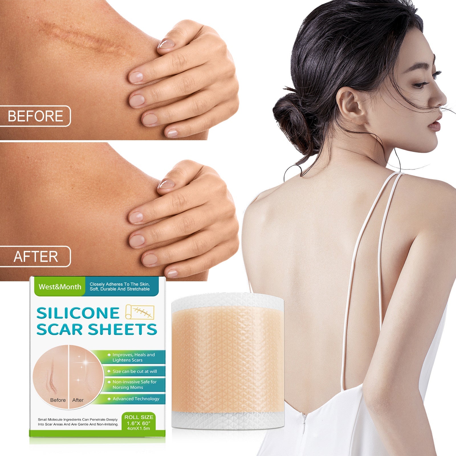 Silicone scar care patches, reusable self-adhesive