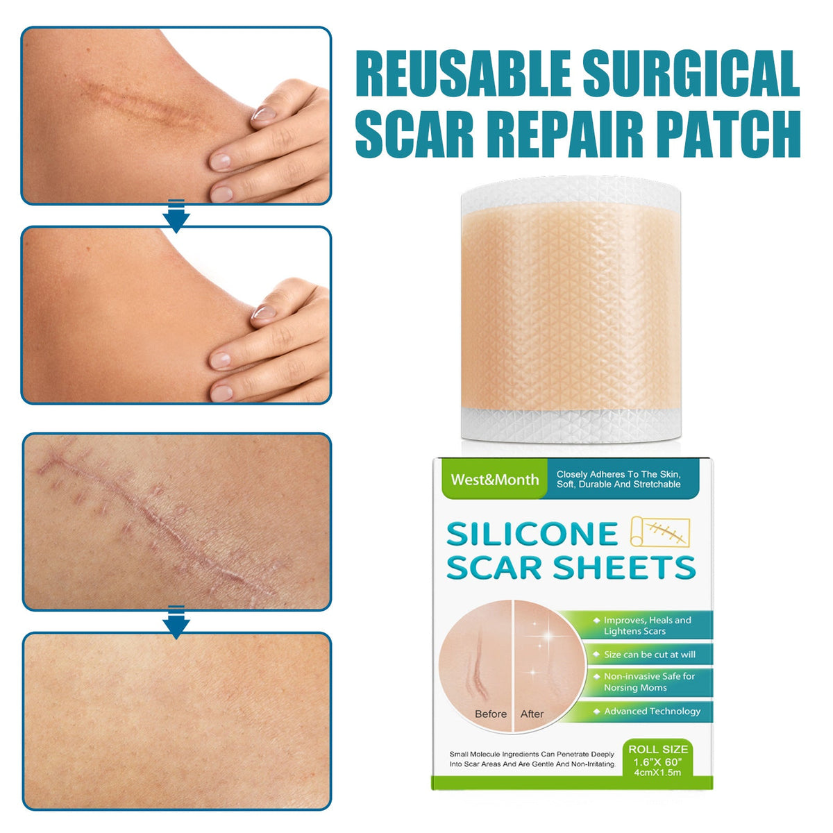 Scar patch silicone material texture